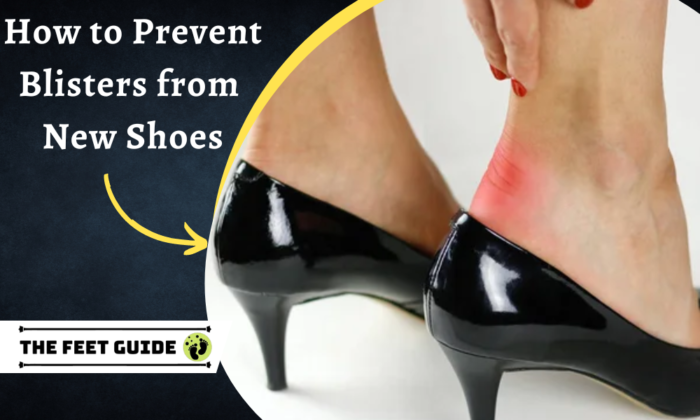How to Prevent Blisters from New Shoes