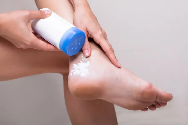 Use Foot Powder or Antiperspirant